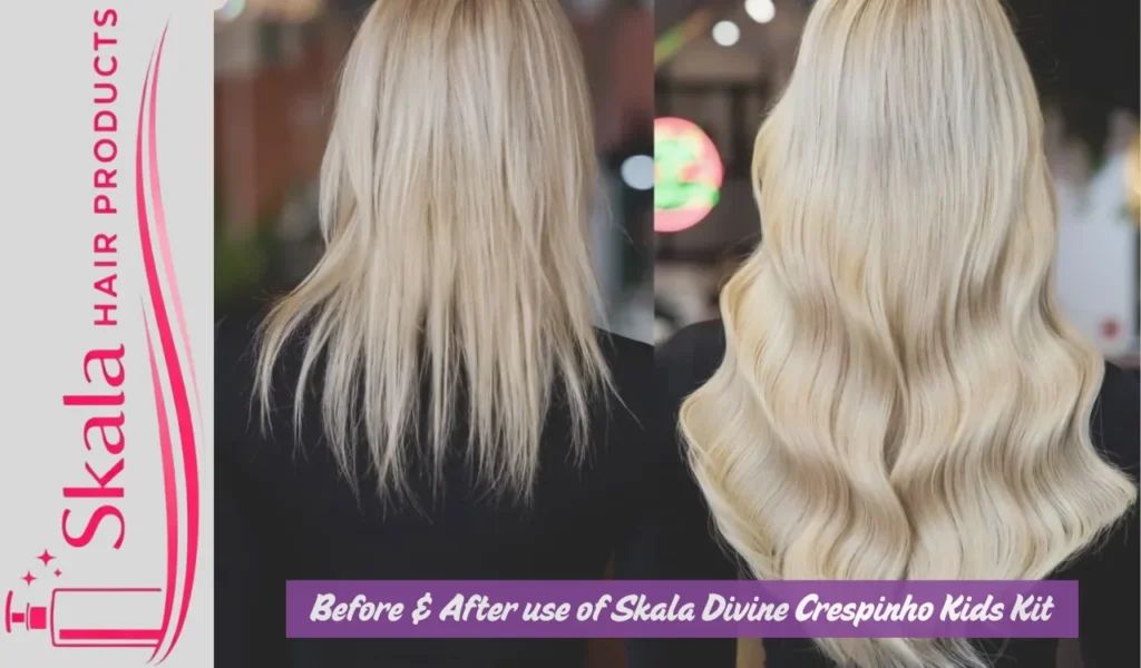 Before & After use of Skala Divine Crespinho Kids Kit