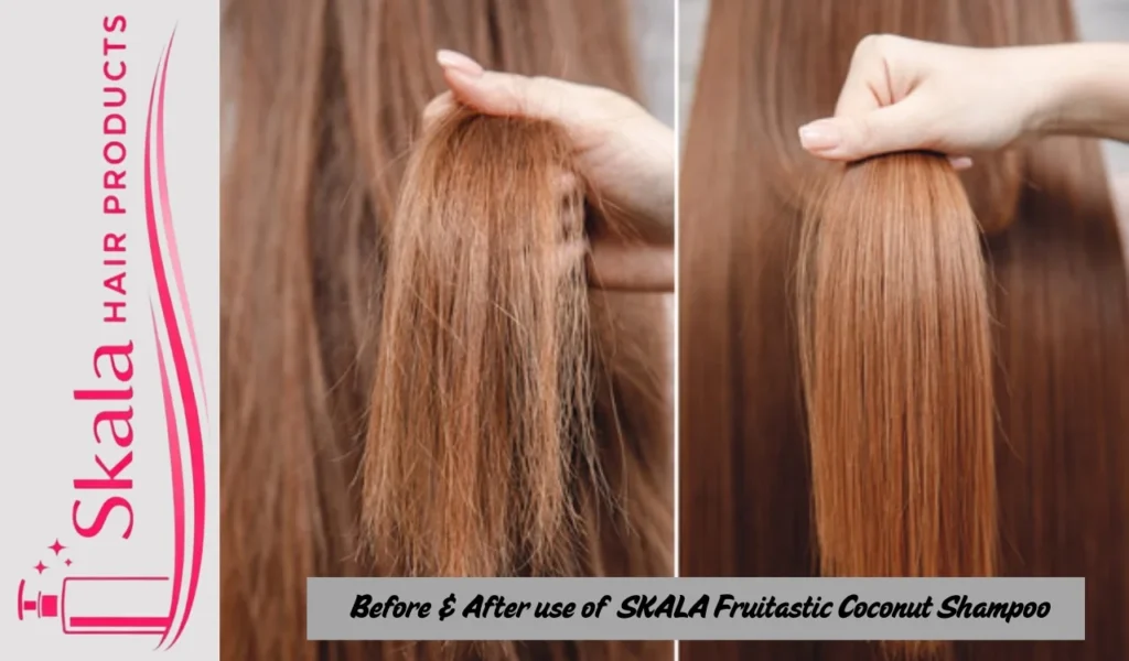 Before & After use of  SKALA Fruitastic Coconut Shampoo