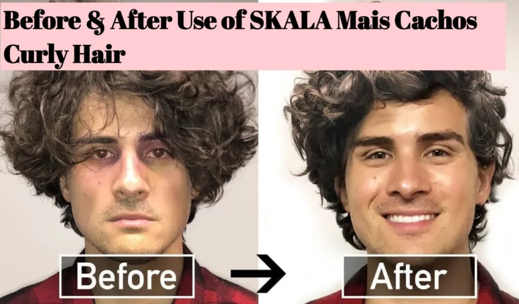 Benefits of SKALA Mais Cachos Curly Hair